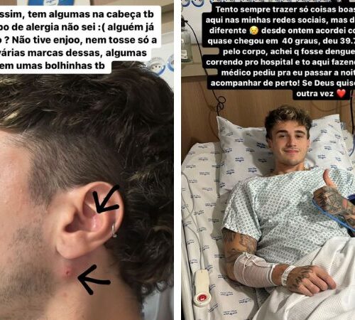 Imagem do post Alex Mapeli é internado alergia e febre, e assunto repercute na internet 